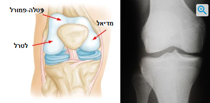 אילוסטרציה וצילום RAY-X המדגימים מפרק ברך בריא 