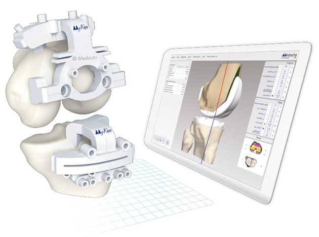 MY KNEE - מערכת להתאמה אישית בניתוחי החלפת מפרק הברך